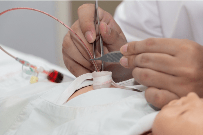 Image of doctor placing umbilical vein catheter.