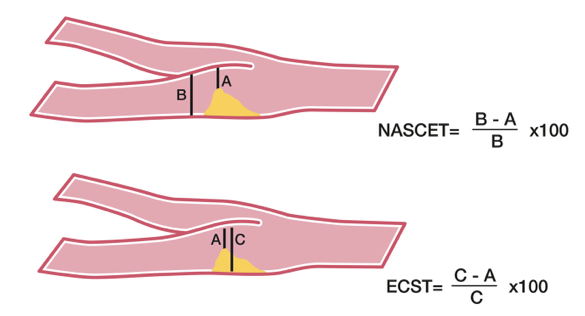 NASCET ECTS