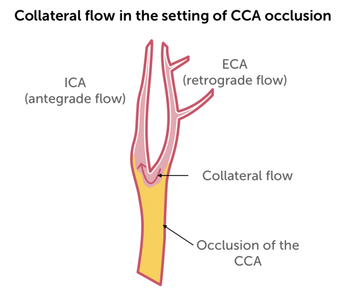 Occlusion