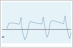 Stage 2 Spectral Doppler