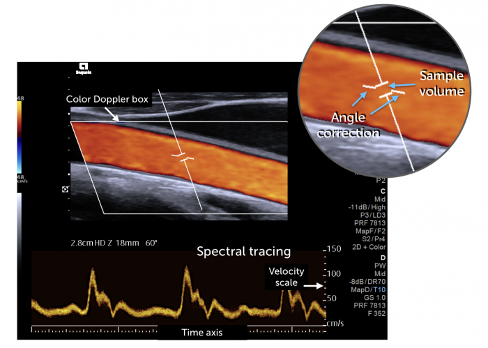 Spectral Explain Spectral Explain