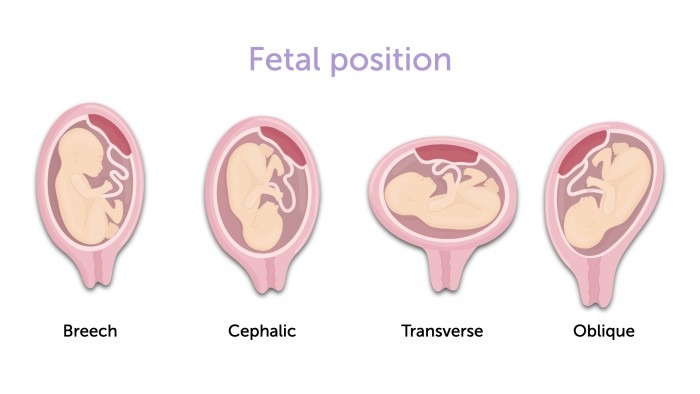 Identify fetal position in late pregnancy | 123sonography