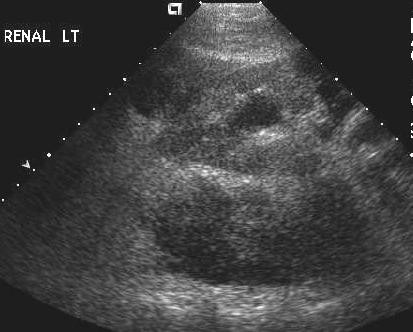 Transverse view of the left kidney