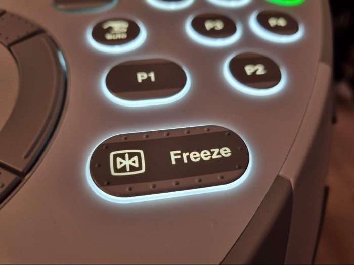 Freeze button on an ultrasound machine.