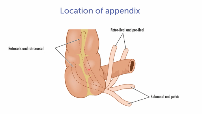 Illustration of the location of the appendix.