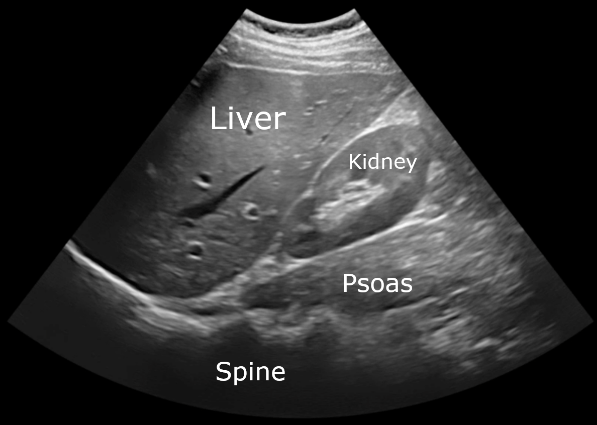 Ultrasound 101 - Part 1: Transducers | 123 Sonography