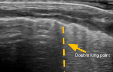 neonatal-ultrasound.png