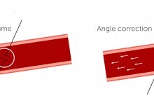 Angle correction