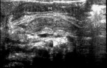 Sagittal image of the epigastric region