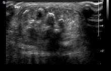 Tranversal view of posterior region, distal segment of right leg