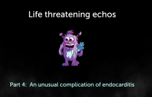Life threatening echos; Part 4: Unusual case of endocarditis. With monster in the middle.