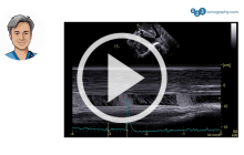 M-Mode Ultrasound image with avatar of Thomas Binder on the left.